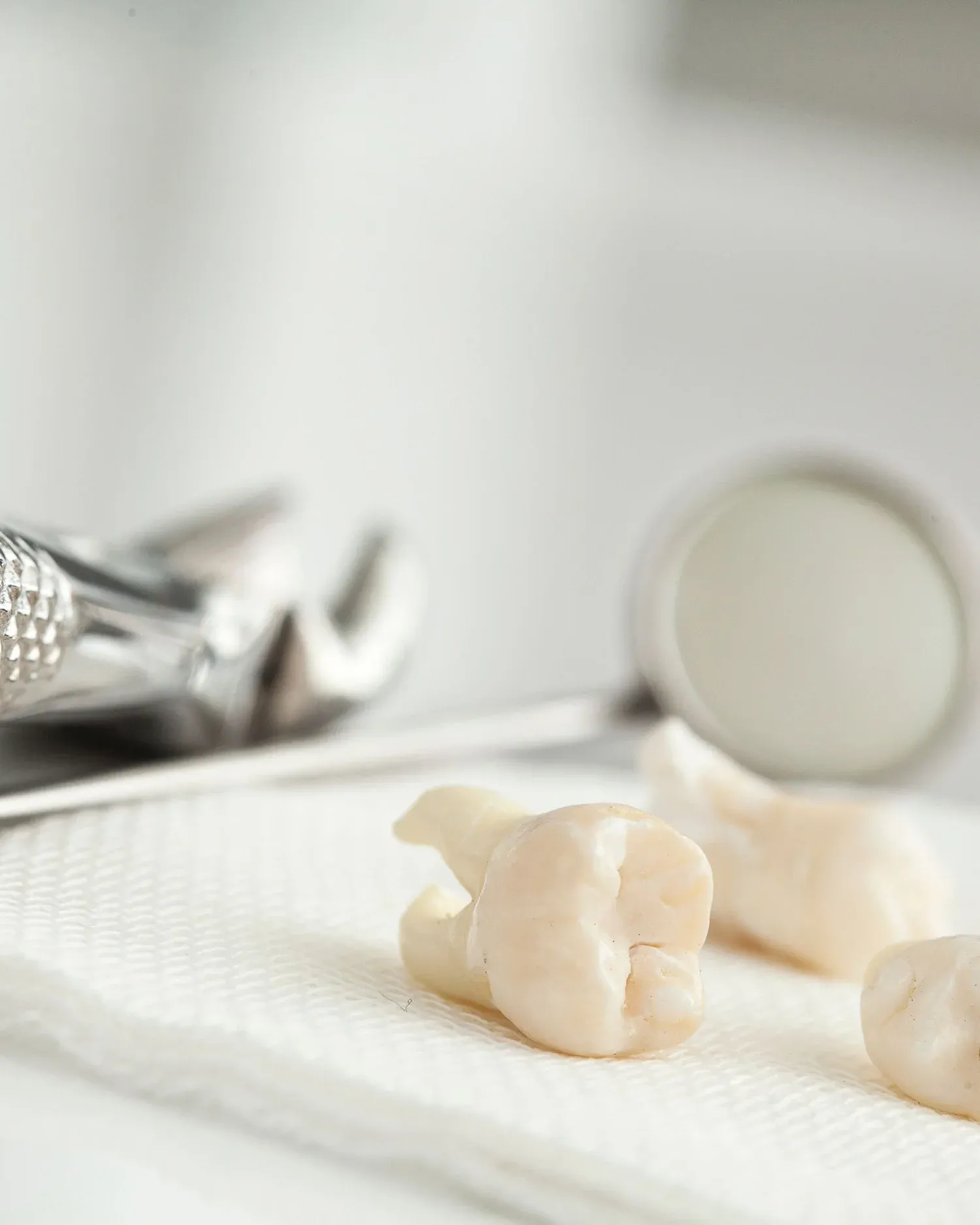 Wisdom Tooth Extraction at e.s.i. Healthy Dentistry